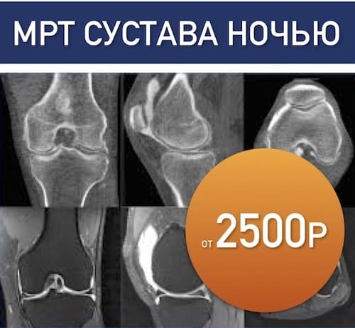 Сделать мр-венография головного мозга в Санкт-Петербурге - ICLINIC
