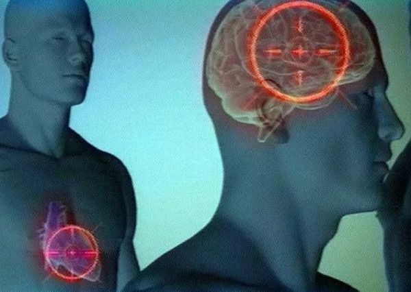 Чем отличается инфаркт миокарда от инсульта головного мозга