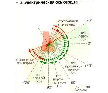 Отклонение эос влево что это такое — Сердце