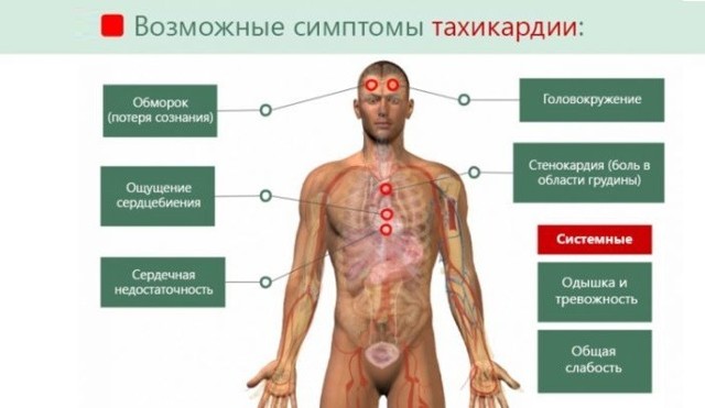 Тахикардия сердца: симптомы, диагностика и лечение - DELFI