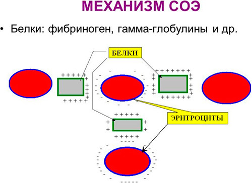 Норма СОЭ в крови у мужчин, женщин и детей по возрасту. Таблица. СОЭ выше нормы