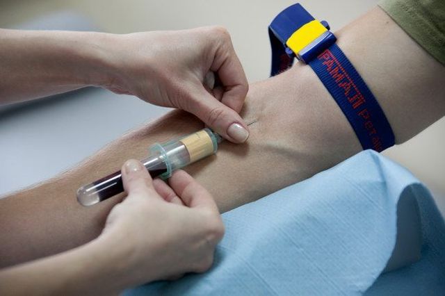 Реакция Вассермана (RW), как называется анализ крови на сифилис?