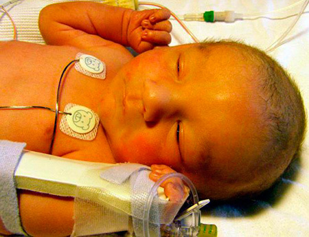 Какова норма билирубина в крови у взрослого человека? Основные показатели.