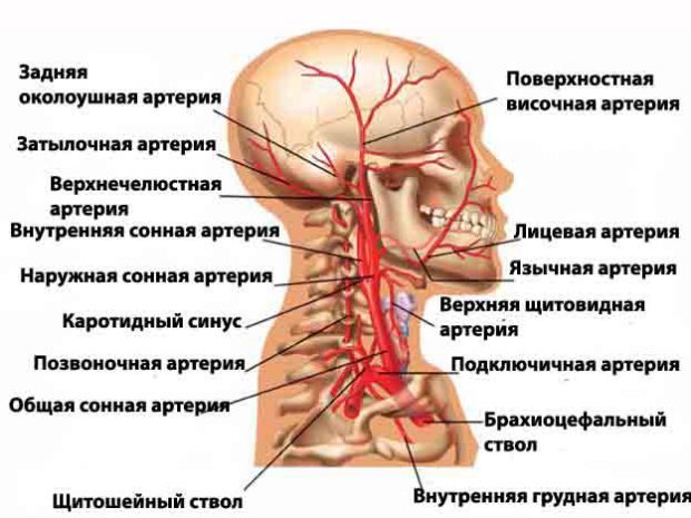 Нестенозирующий атеросклероз БЦА - что это такое?