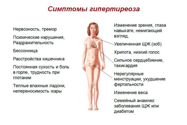 Гипертиреоз - причины, симптомы, диагностика и лечение