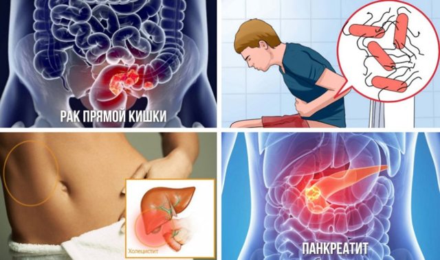 Облепиха при геморрое и трещинах: как применять свечи, рецепты, отзывы