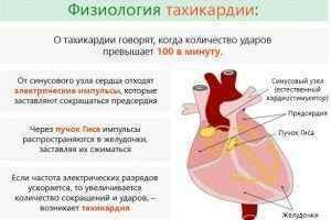 Тахикардия сердца: симптомы, диагностика и лечение - DELFI