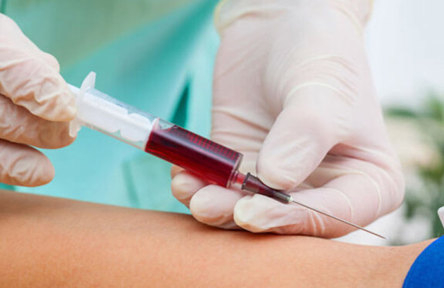 Почему при месячных идет кровь: норма и паталогия