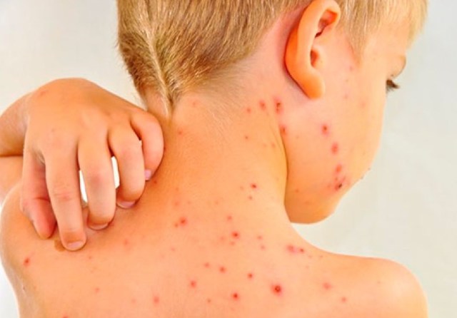 Хвороби корів: причини, симптоми, способи лікування, профілактика тварин