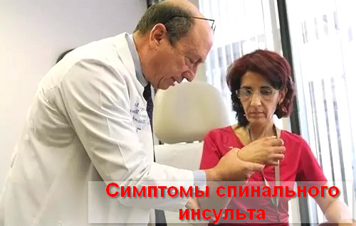 Инсульт спинного мозга (спинальный): симптомы, лечение, последствия