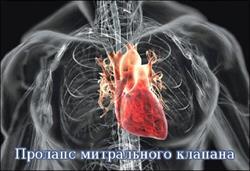 Что такое блокада сердца 1 степени