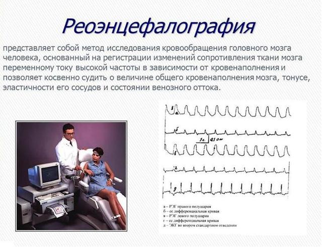 РЭГ (реоэнцефалография) сосудов головного мозга: что это такое и что показывает, методика обследования, расшифровка