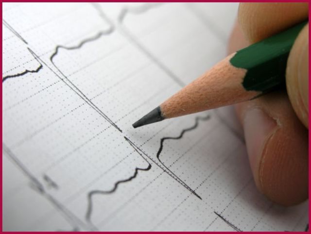 Пульс нитевидный это - Все про гипертонию