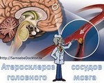 Коагулограмма - обязательный анализ при беременности, перед операцией