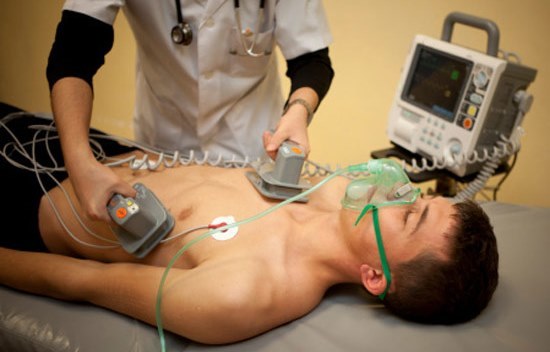 Пароксизмальная мерцательная аритмия: причины, лечение