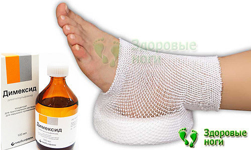 Пяточная шпора - симптомы и лечение в домашних условиях эффективными способами