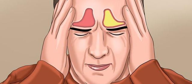 Острый фронтит что такое, симптомы и лечение у взрослых