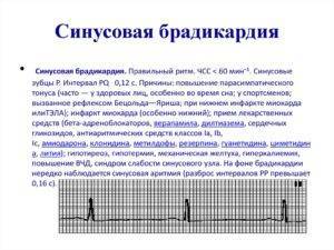 Тенденция к брадикардии у ребенка - Все про гипертонию