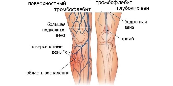 Индовазин мазь: инструкция, аналоги, показания к применению