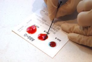 Заболевания по группе крови (болезни, влияющие на здоровье)