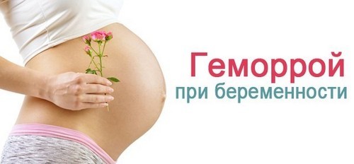 Геморрой при беременности - чем и как лечить геморрой беременной?