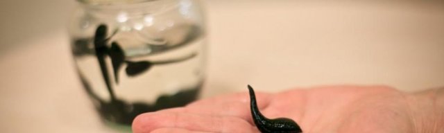 Пиявки на копчик - применение гирудотерапии для женщин и мужчин