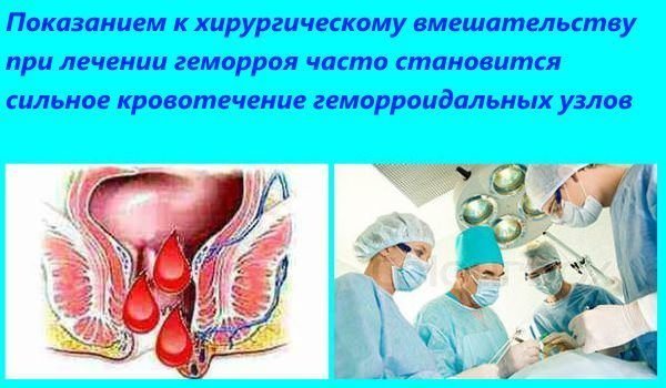 Геморрой что делать если вылез и болит, кровоточит - лечение у мужчин и женщин