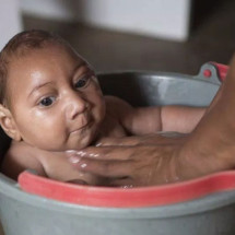 Вирус Зика - причины, симптомы и лечение Zika virus
