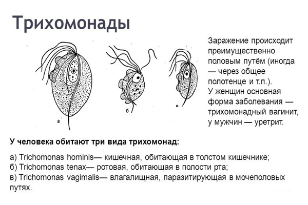 Что такое трихомониаз? Причины возникновения и способы лечения