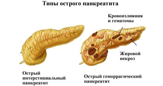 Повышены АЛТ и АСТ в крови у взрослого, ребенка в 2-3 раза: что это значит?