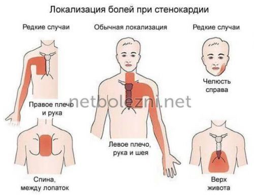 О чем говорит боль в грудной клетке посередине при вдохе? О чем говорят боли в грудной клетке при вдохе