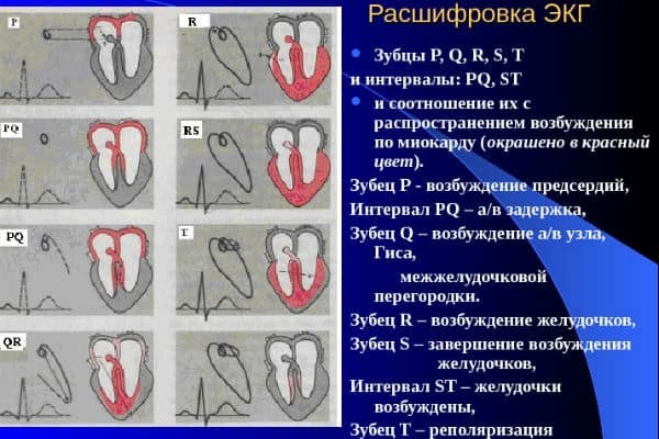 Расшифровка ЭКГ в норме и при патологии. Уроки по ЭКГ с видео