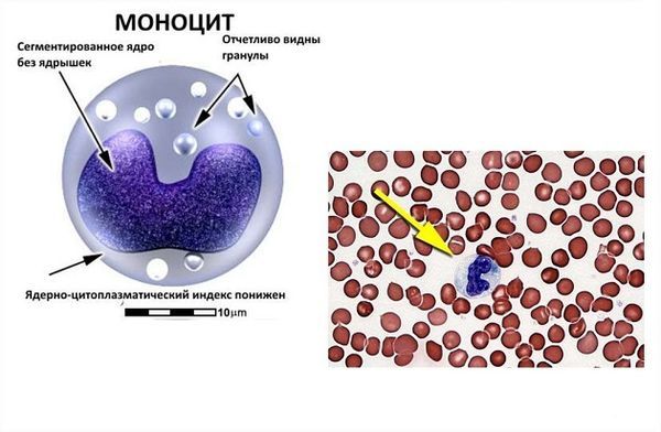 Моноциты в крови повышены