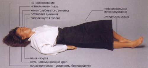 Судороги в ногах причины и обморок - Лечение обмороков