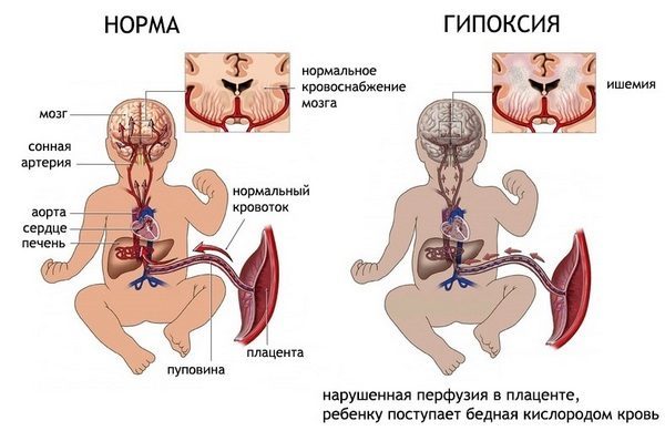 Нормы допплерографического исследования