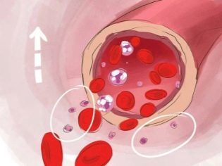 Тромбоциты при беременности: возможные проблемы. Что делать, если повышены тромбоциты при беременности