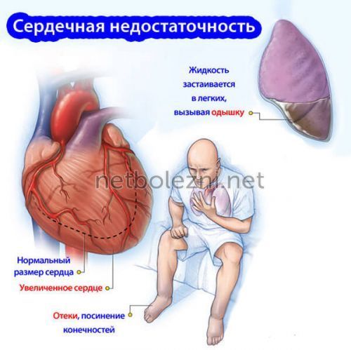 Тяжело дышать не хватает воздуха что делать