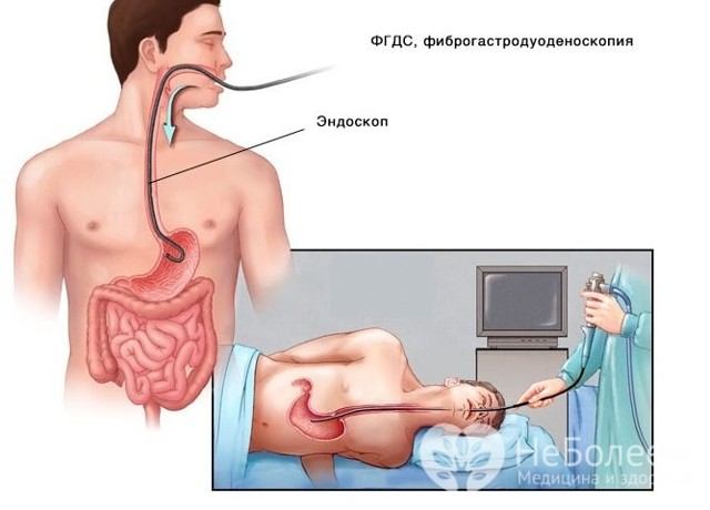 Кровь в желудке: причины и симптомы, диагностика и лечение