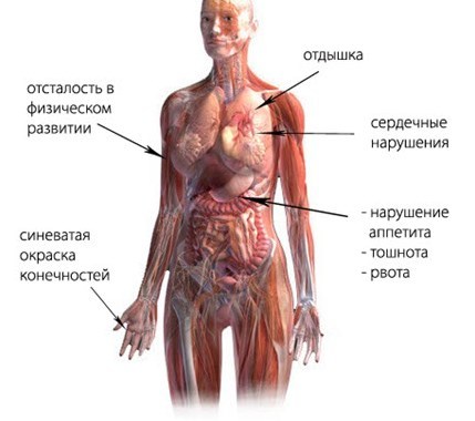 Нуд по смешанному типу что это такое - Лечение гипертонии