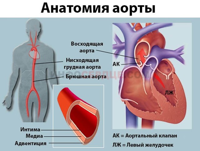 Аорта развернута что это значит. Аорта уплотнена и развернута что это