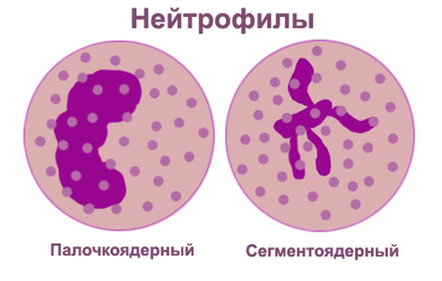 Почему нейтрофилы повышены при беременности в крови? - МамаДома