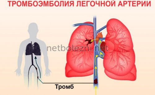 Болит и давит в грудной клетке и трудно дышать: причины боли, диагностика и лечение