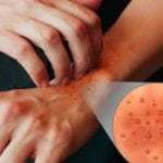 Стевия - польза и вред для похудения, при беременности