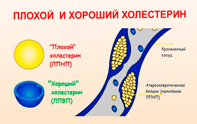 Низкое диастолическое давление – причины и меры лечения