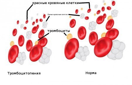 Тромбоциты в крови понижены: симптомы и лечение