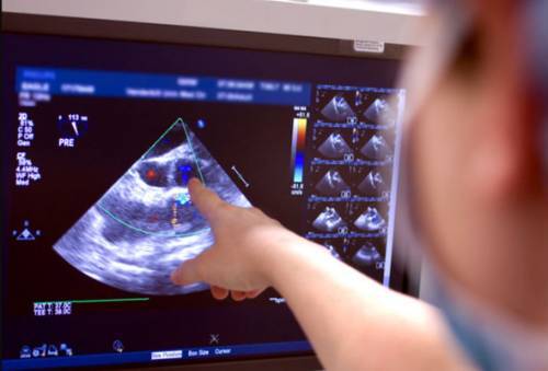 Эхо КГ сердца что это такое, как делают