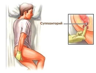 Через сколько действуют глицериновые свечи при запоре у взрослого