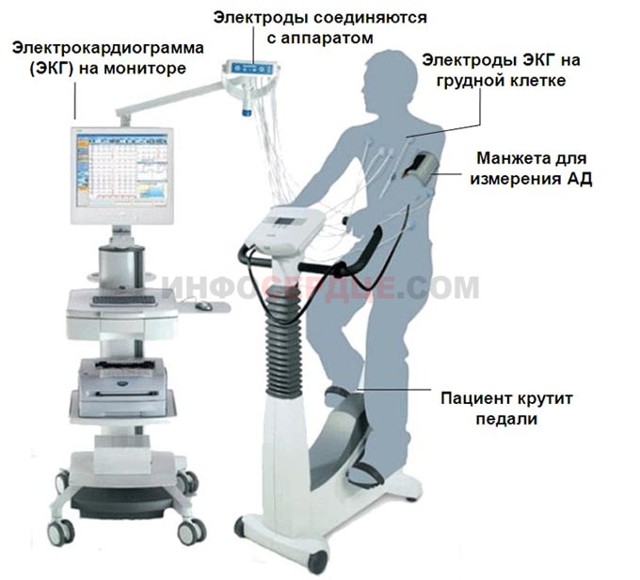 Велоэргометрия (ВЭМ). Проведение сердечного диагностического теста.