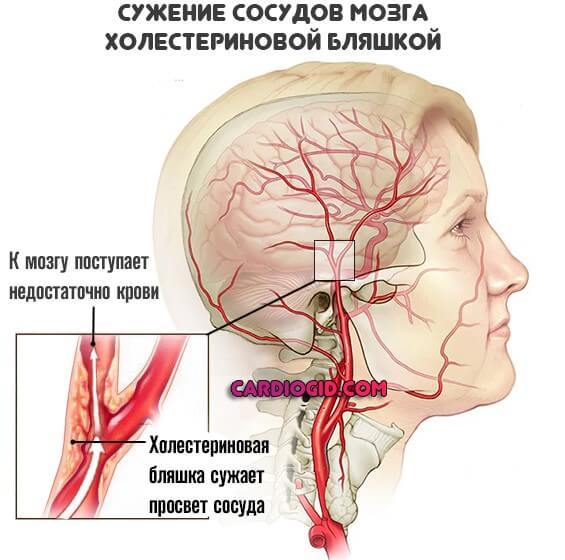 Высокое нижнее давление: причины и лечение