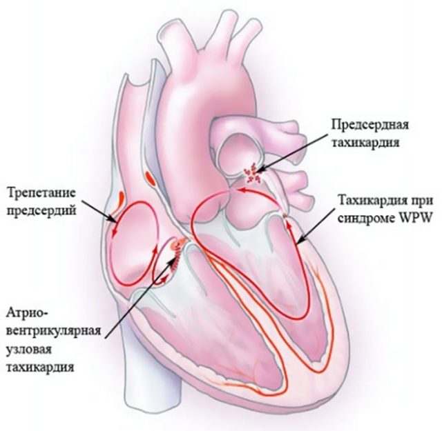 Какие лекарства принимать при учащенном сердцебиении, что принимать при тахикардии